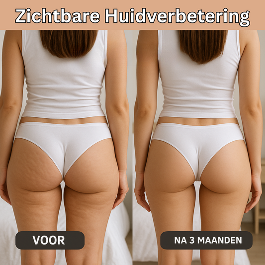 LAVELLA| Innovatieve 3D Anti-Cellulitis Legging